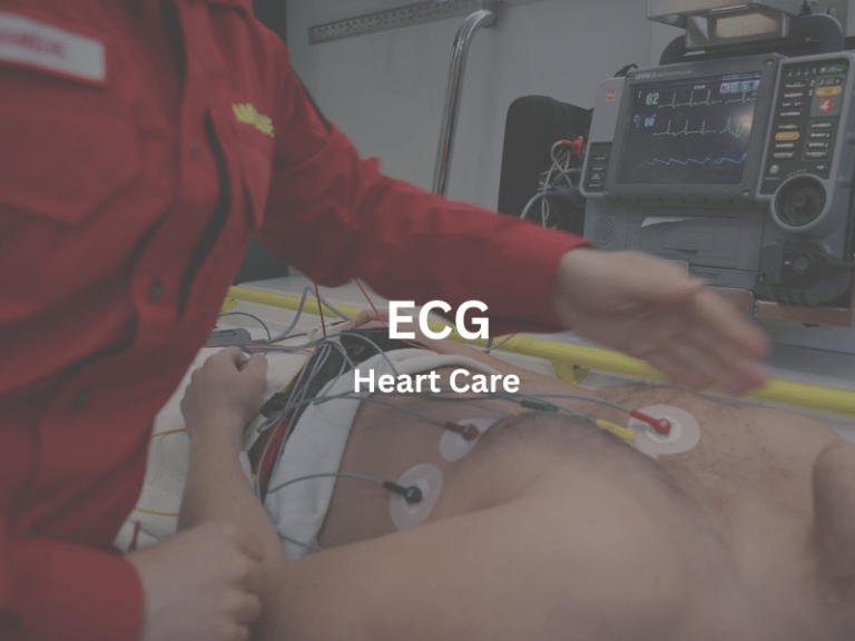 ecg